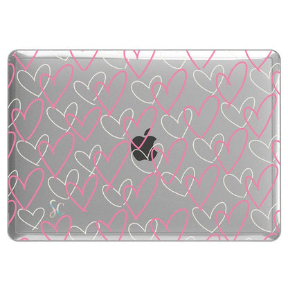 Case Macbook Transparente Infinity